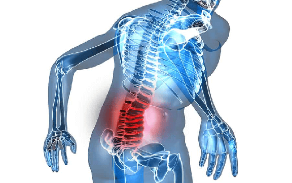 Bị đau lưng dưới biểu hiện như thế nào? Nguyên nhân và cách điều trị